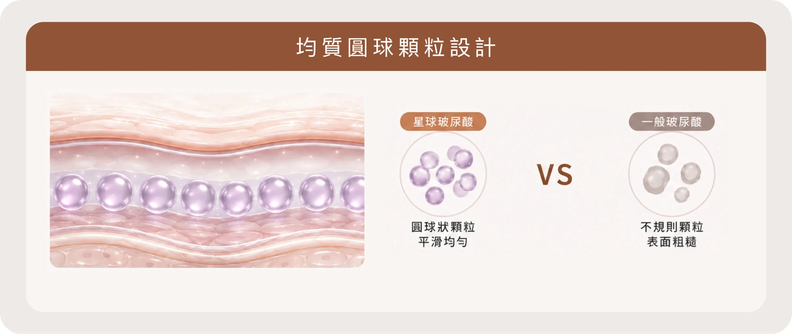 玻尿酸淚溝填補修飾